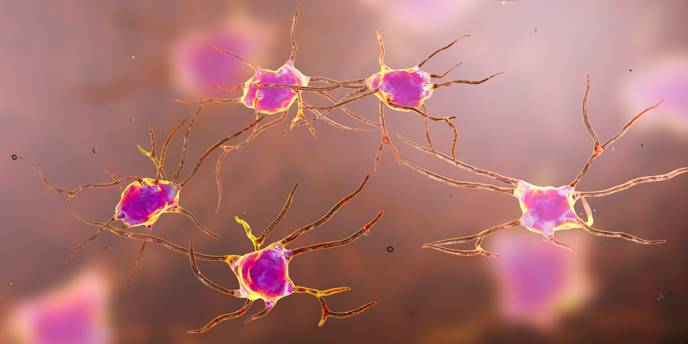 What is ataxic cerebral palsy?